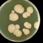 CÓMO CURAR Y PREVENIR LA CANDIDIASIS CON PLANTAS